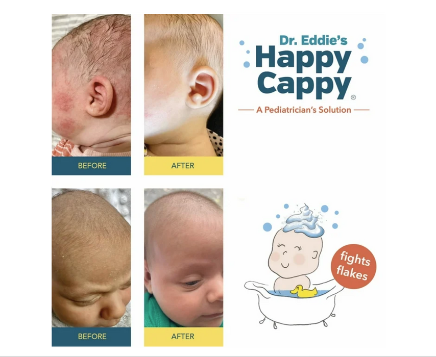 Dr. Eddie's Happy Cappy, Medicated Shampoo & Body Wash for Seborrheic Dermatitis & Dandruff -8oz