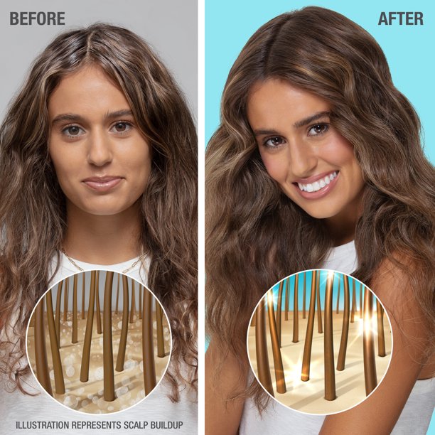 Neutrogena Healthy Hydro Boost Hyaluronic Acid Hair Treatment Scalp Care, 6.8 fl oz